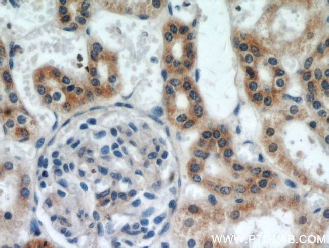 SLC38A4 Antibody in Immunohistochemistry (Paraffin) (IHC (P))