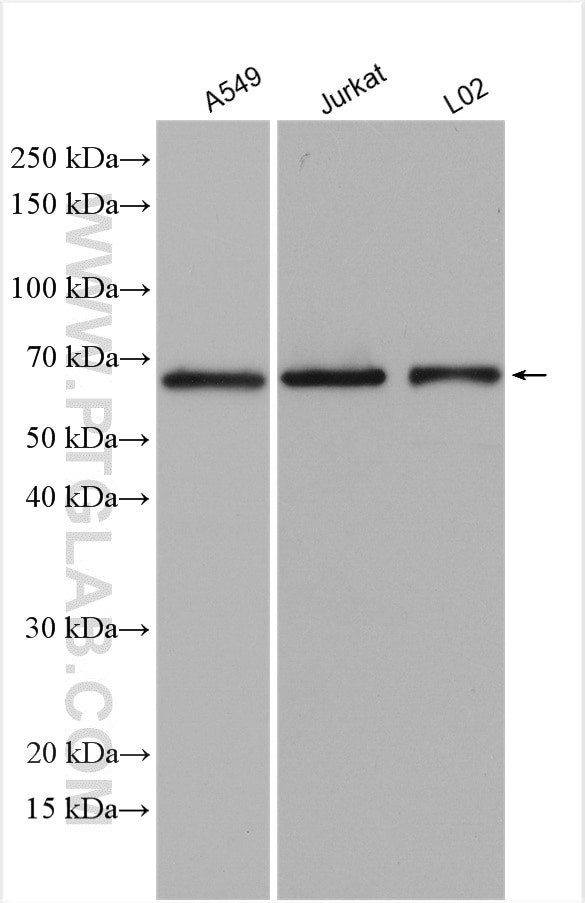 SLC38A4 Antibody in Western Blot (WB)