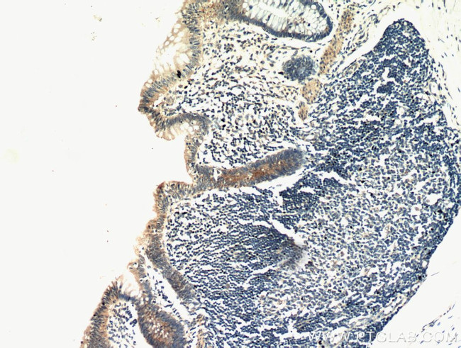 CCDC93 Antibody in Immunohistochemistry (Paraffin) (IHC (P))