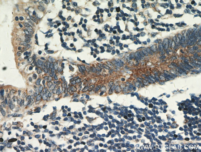 CCDC93 Antibody in Immunohistochemistry (Paraffin) (IHC (P))