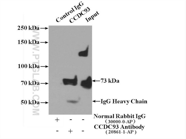 CCDC93 Antibody in Immunoprecipitation (IP)