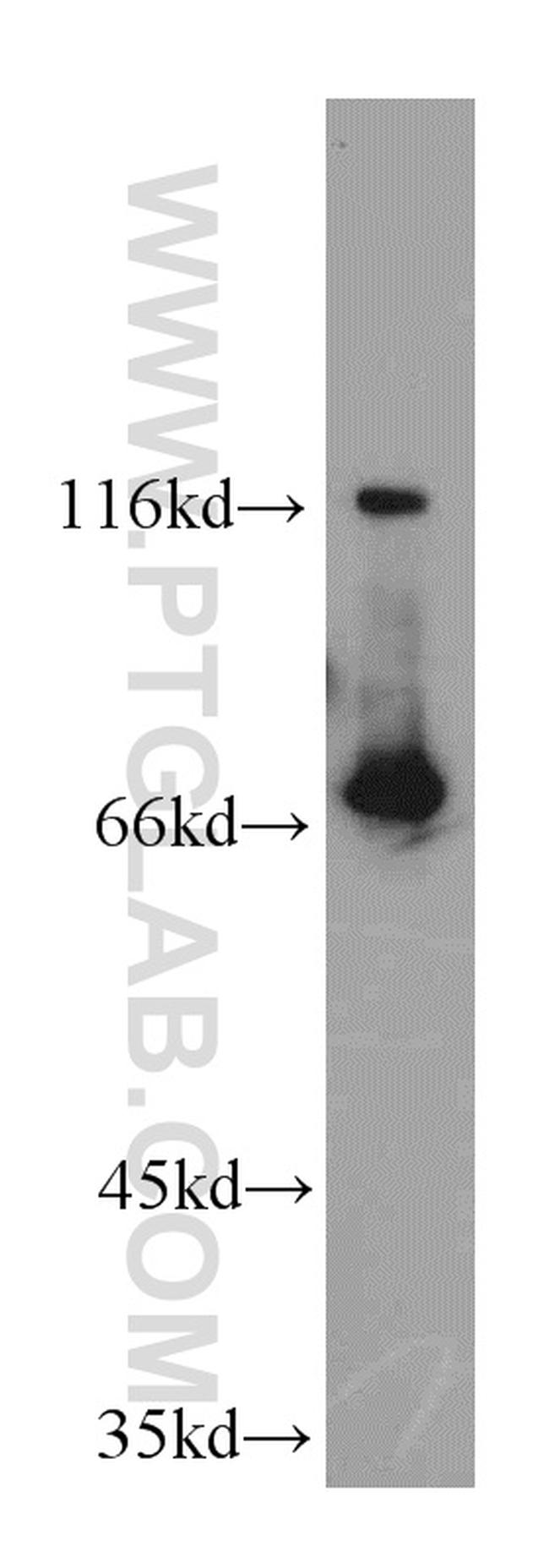 CCDC93 Antibody in Western Blot (WB)