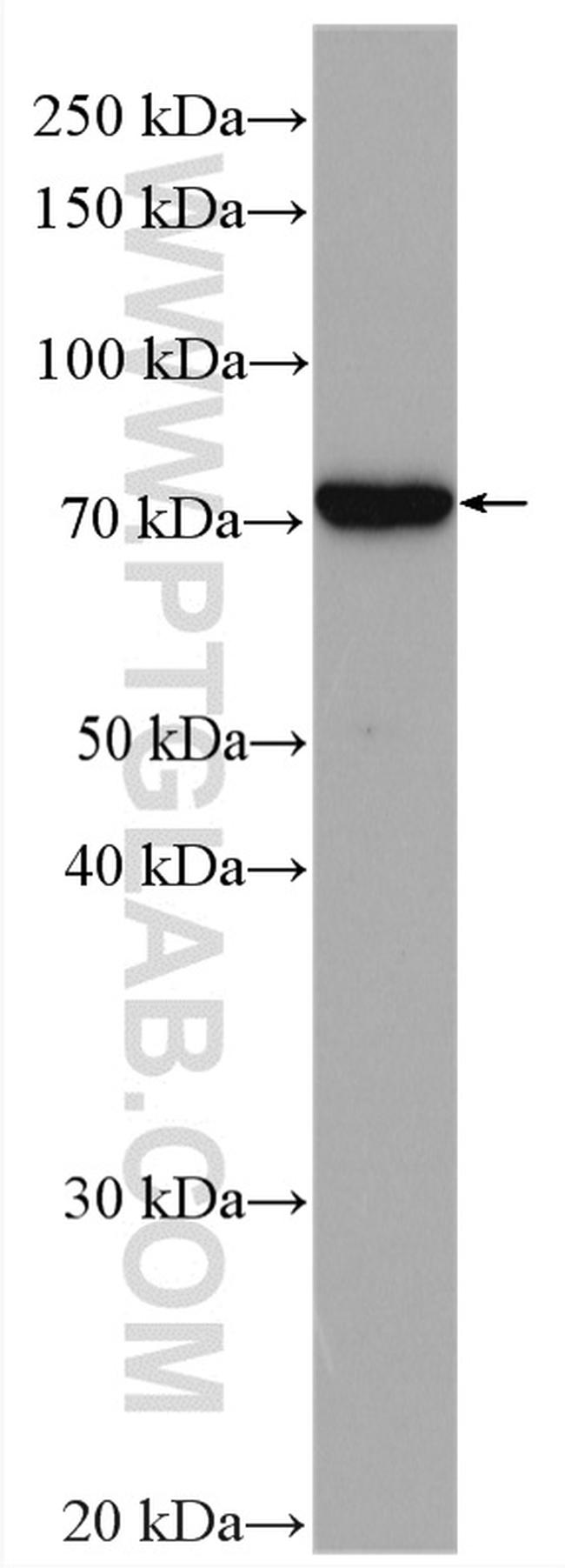 CCDC93 Antibody in Western Blot (WB)