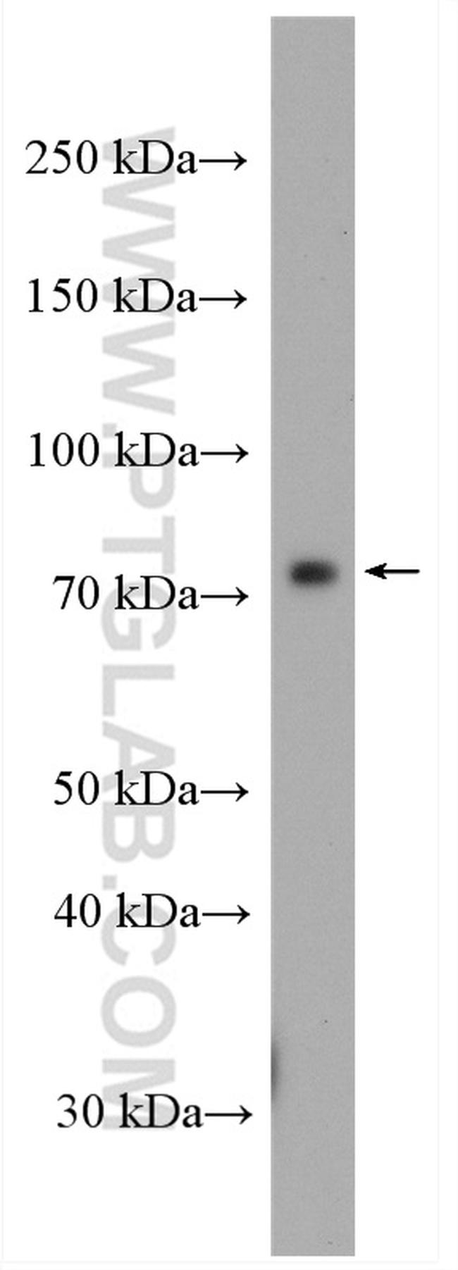 CCDC93 Antibody in Western Blot (WB)