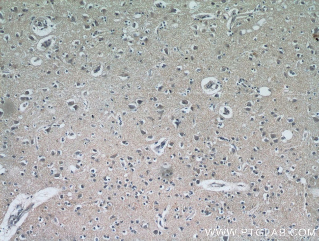 FAM76A Antibody in Immunohistochemistry (Paraffin) (IHC (P))