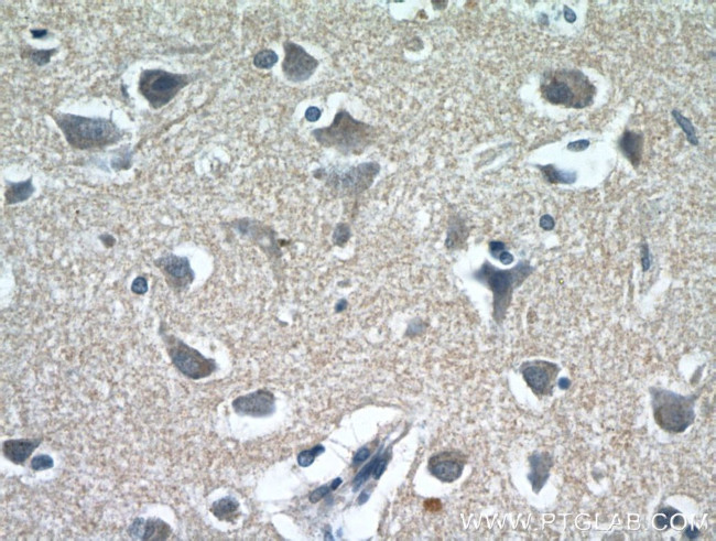 FAM76A Antibody in Immunohistochemistry (Paraffin) (IHC (P))