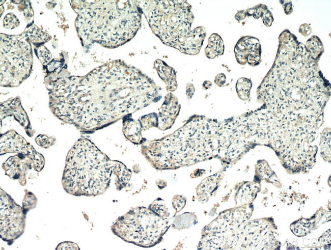 FAM76A Antibody in Immunohistochemistry (Paraffin) (IHC (P))