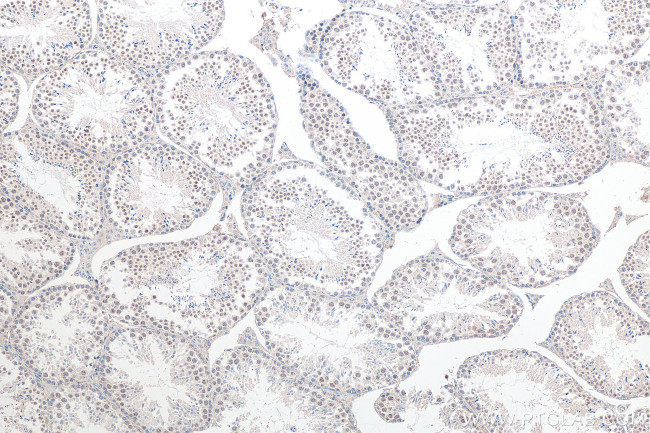 FAM76A Antibody in Immunohistochemistry (Paraffin) (IHC (P))