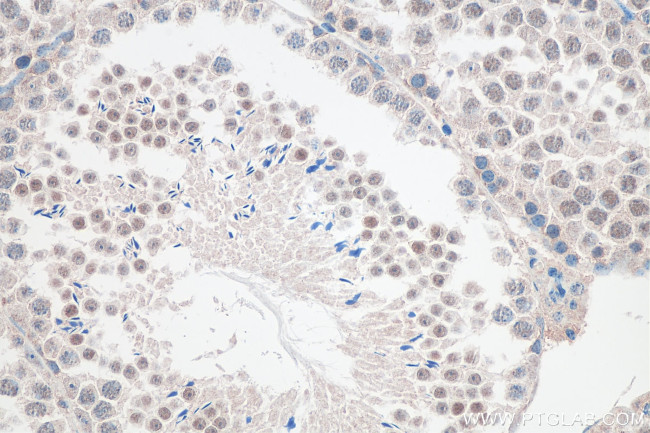 FAM76A Antibody in Immunohistochemistry (Paraffin) (IHC (P))