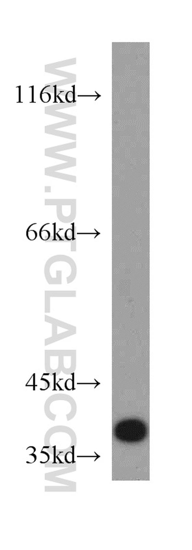 FAM76A Antibody in Western Blot (WB)