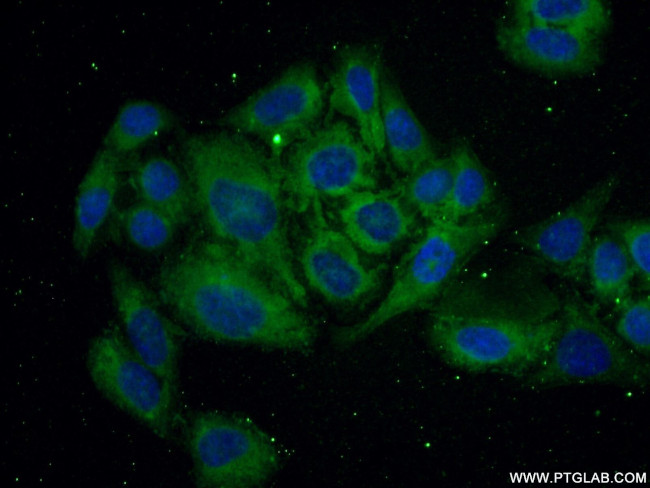 TFPI Antibody in Immunocytochemistry (ICC/IF)