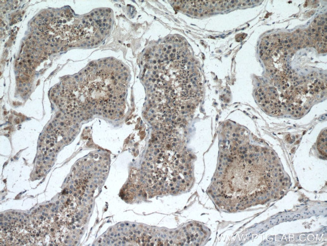 RHBDD1 Antibody in Immunohistochemistry (Paraffin) (IHC (P))