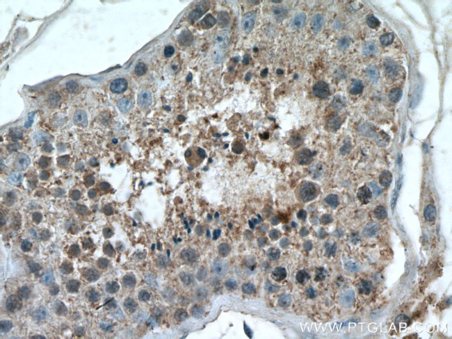 RHBDD1 Antibody in Immunohistochemistry (Paraffin) (IHC (P))