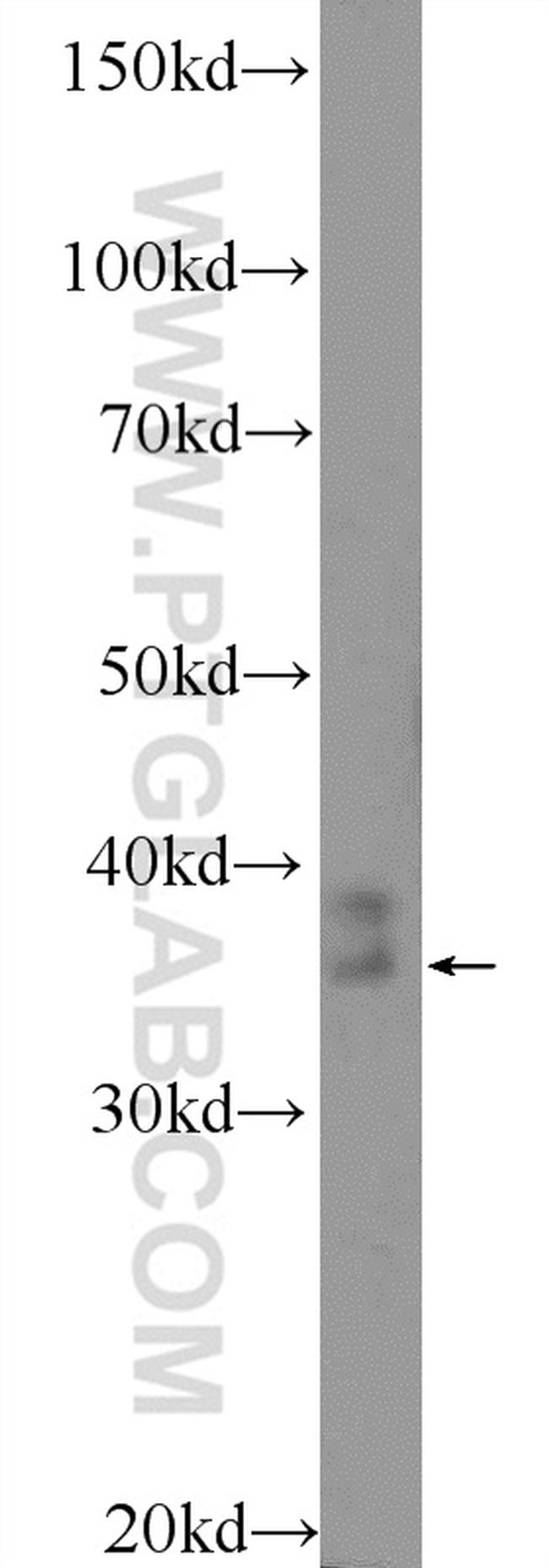 RHBDD1 Antibody in Western Blot (WB)