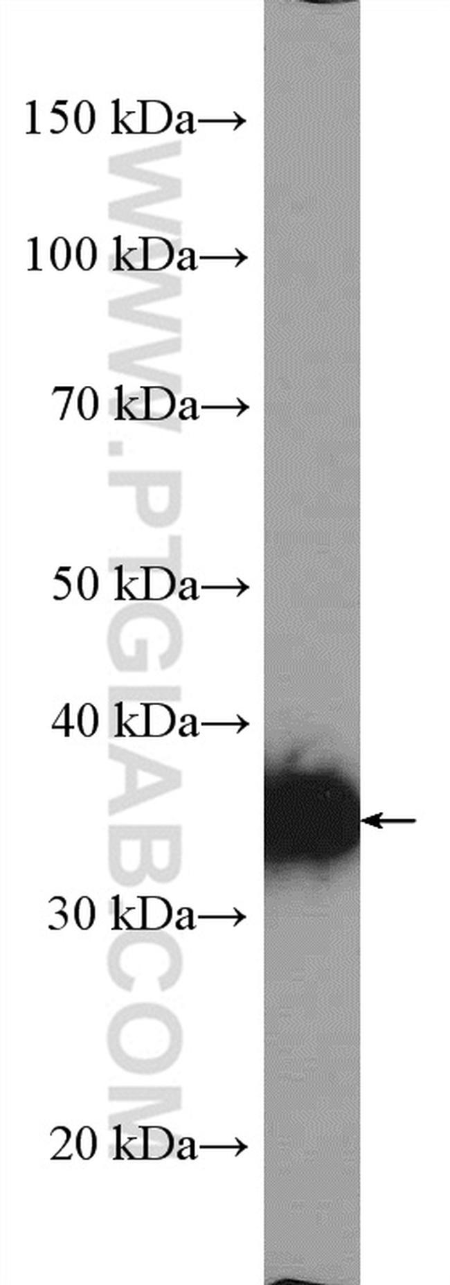 RHBDD1 Antibody in Western Blot (WB)