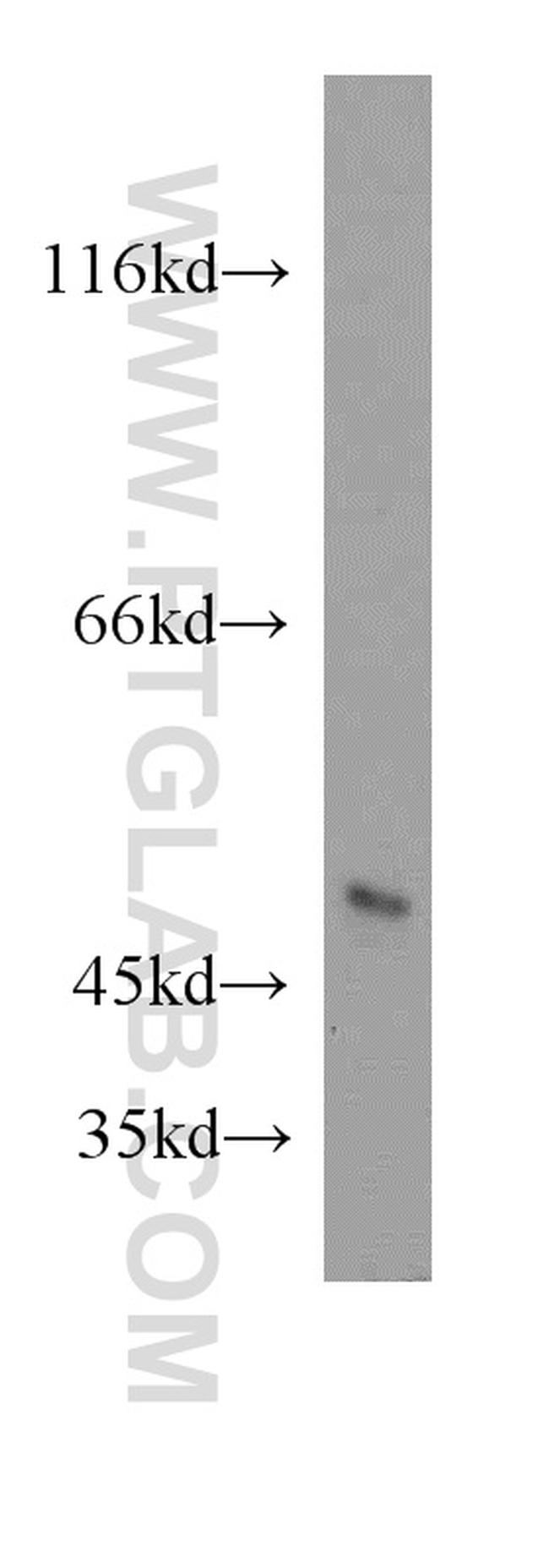 GABPB2 Antibody in Western Blot (WB)