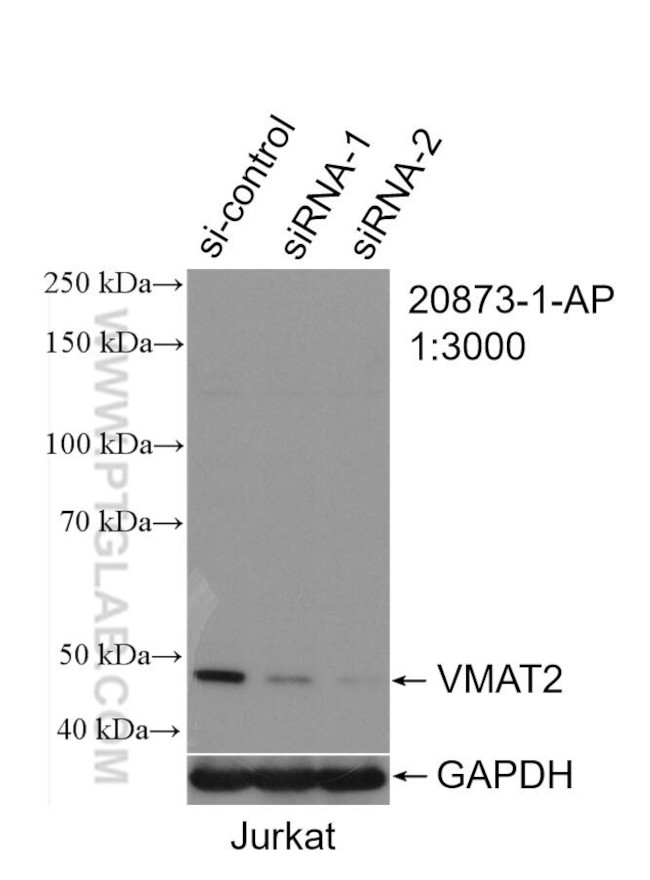 VMAT2 Antibody in Western Blot (WB)