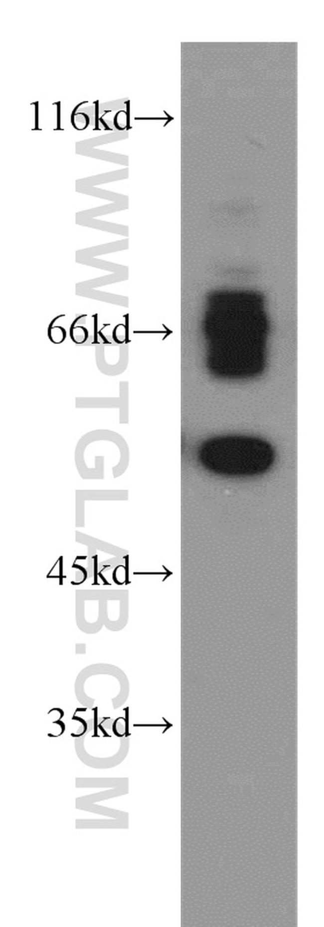 VMAT2 Antibody in Western Blot (WB)