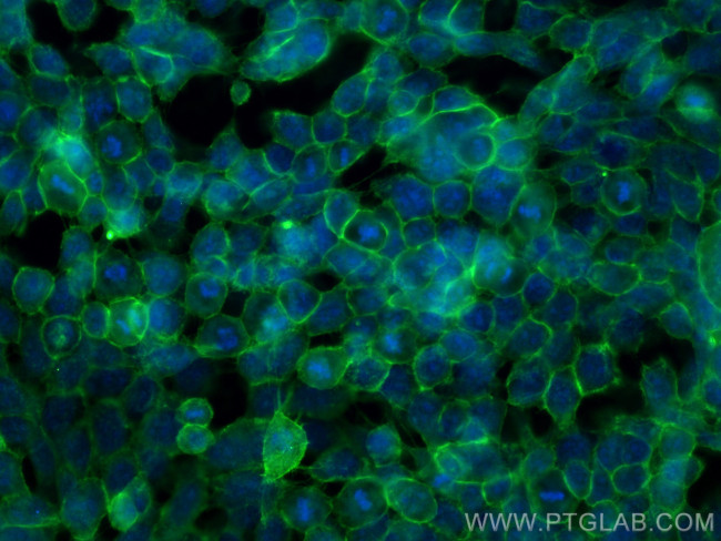 E-cadherin Antibody in Immunocytochemistry (ICC/IF)