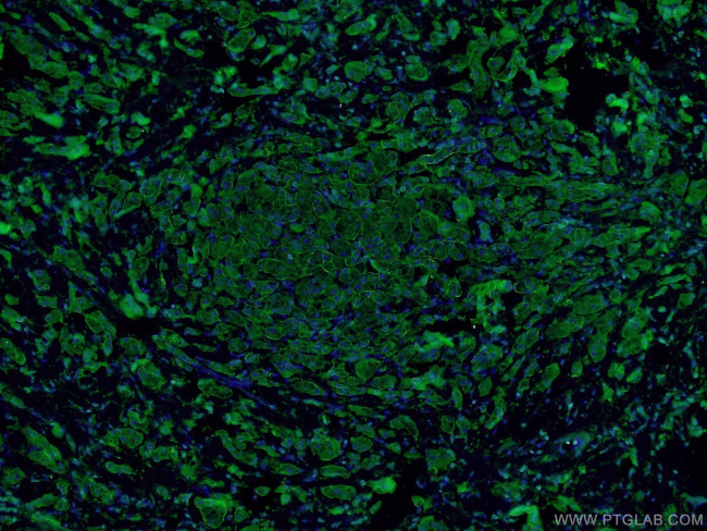 E-cadherin Antibody in Immunohistochemistry (PFA fixed) (IHC (PFA))