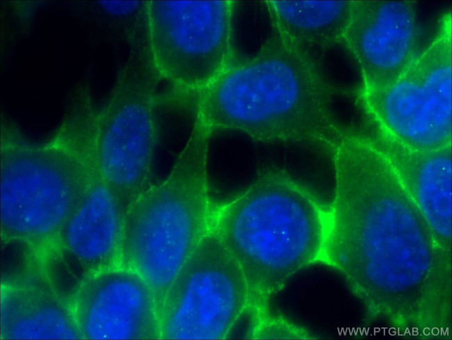 E-cadherin Antibody in Immunocytochemistry (ICC/IF)