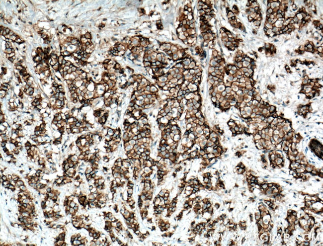 E-cadherin Antibody in Immunohistochemistry (Paraffin) (IHC (P))