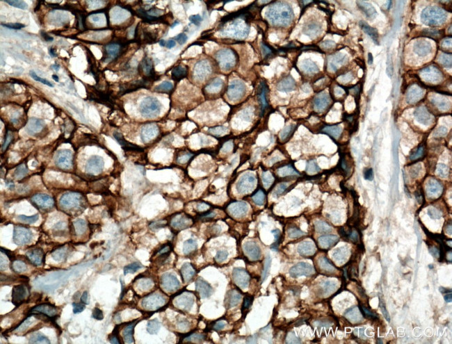 E-cadherin Antibody in Immunohistochemistry (Paraffin) (IHC (P))