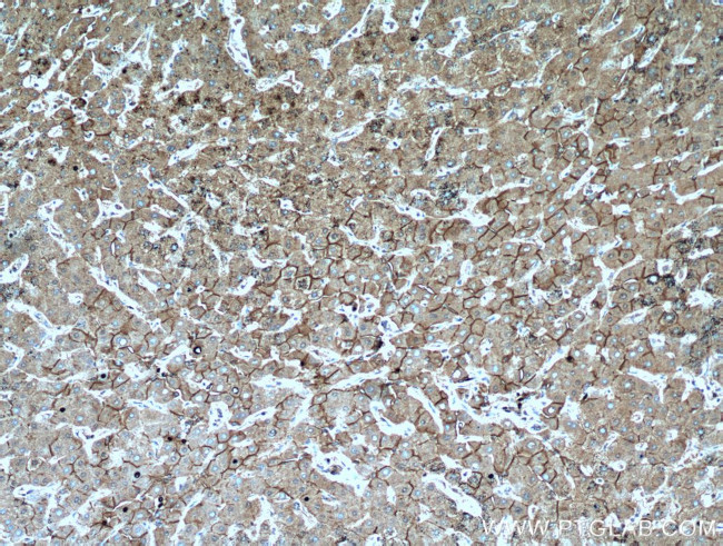 E-cadherin Antibody in Immunohistochemistry (Paraffin) (IHC (P))