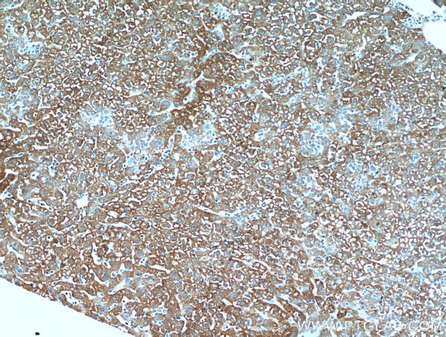 E-cadherin Antibody in Immunohistochemistry (Paraffin) (IHC (P))