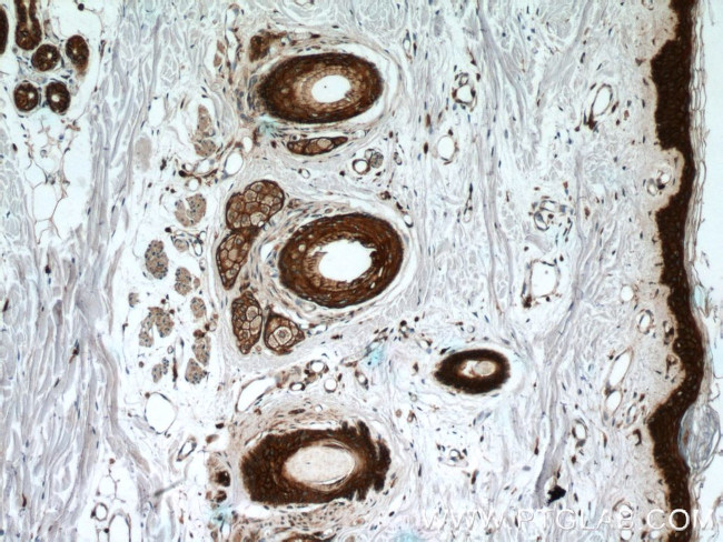 E-cadherin Antibody in Immunohistochemistry (Paraffin) (IHC (P))