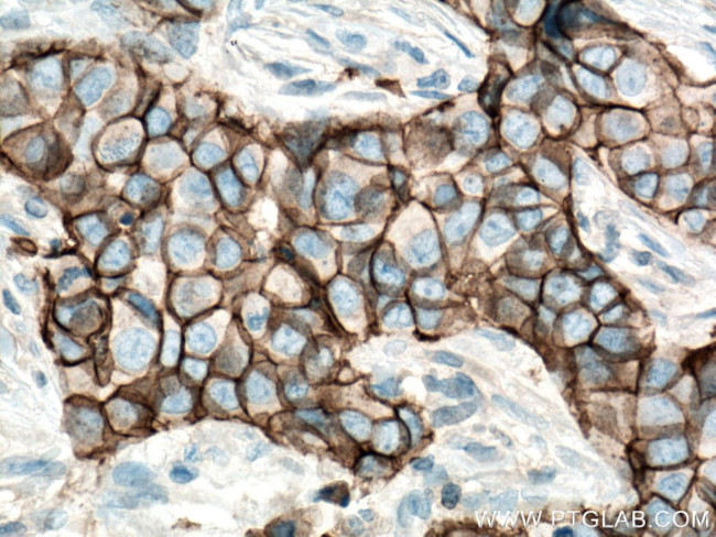 E-cadherin Antibody in Immunohistochemistry (Paraffin) (IHC (P))