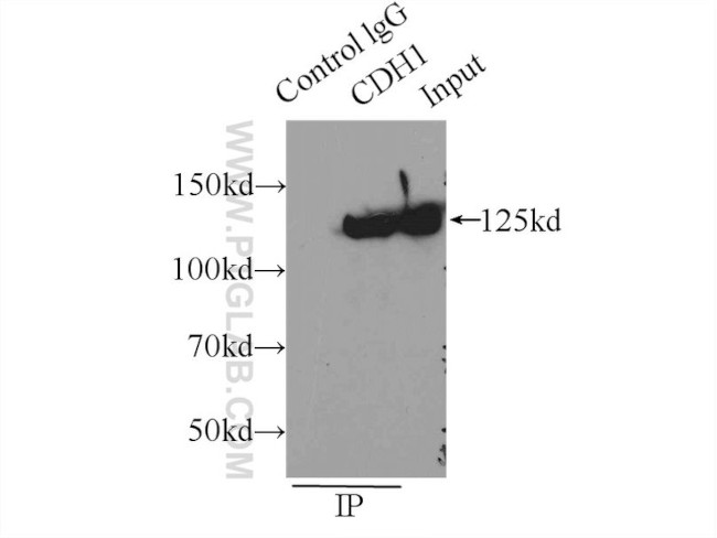 E-cadherin Antibody in Immunoprecipitation (IP)