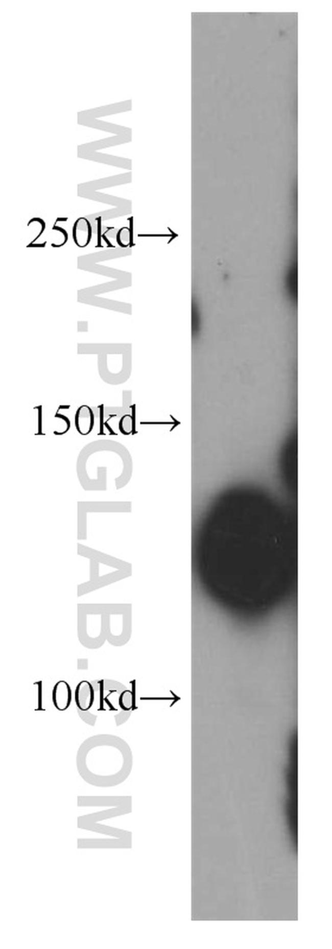 E-cadherin Antibody in Western Blot (WB)