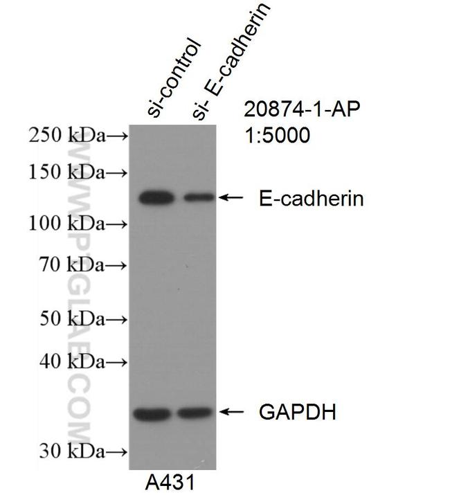 E-cadherin Antibody in Western Blot (WB)