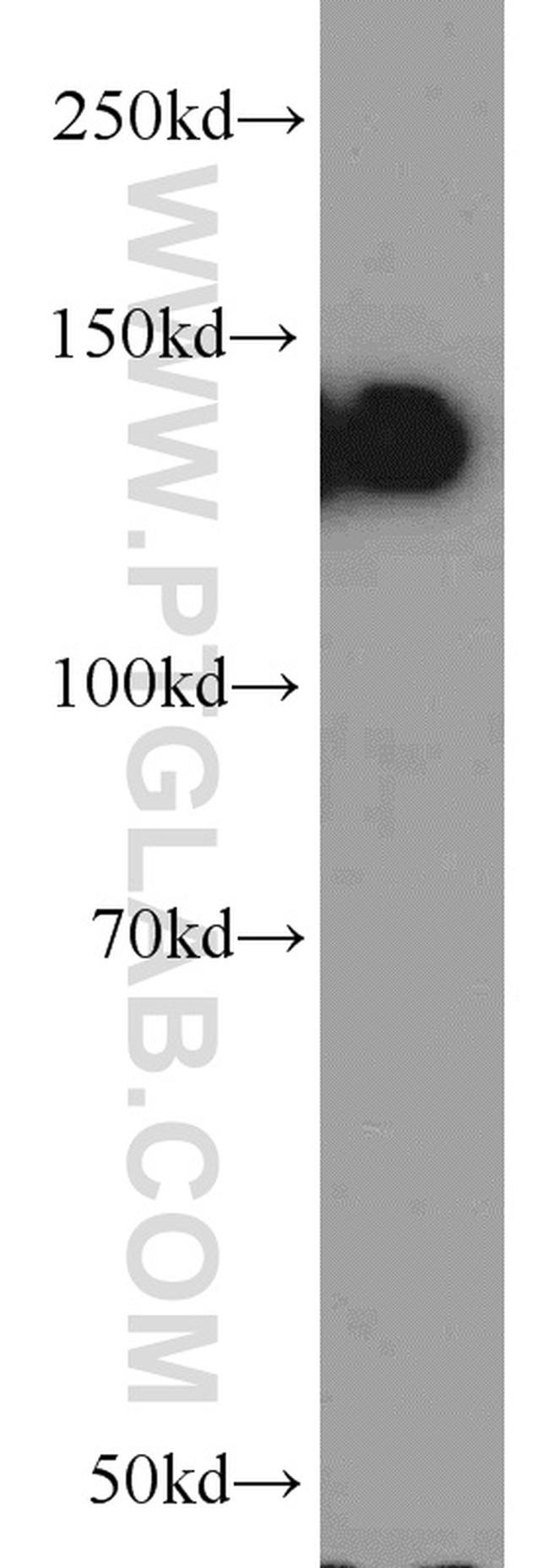 E-cadherin Antibody in Western Blot (WB)