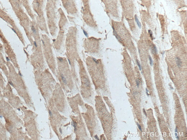 TTC19 Antibody in Immunohistochemistry (Paraffin) (IHC (P))