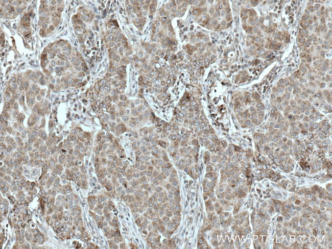 TTC19 Antibody in Immunohistochemistry (Paraffin) (IHC (P))