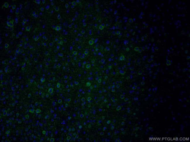 PKC epsilon Antibody in Immunohistochemistry (PFA fixed) (IHC (PFA))