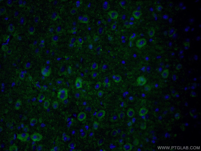 PKC epsilon Antibody in Immunohistochemistry (PFA fixed) (IHC (PFA))