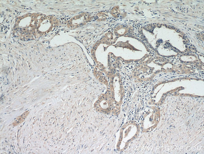 PKC epsilon Antibody in Immunohistochemistry (Paraffin) (IHC (P))