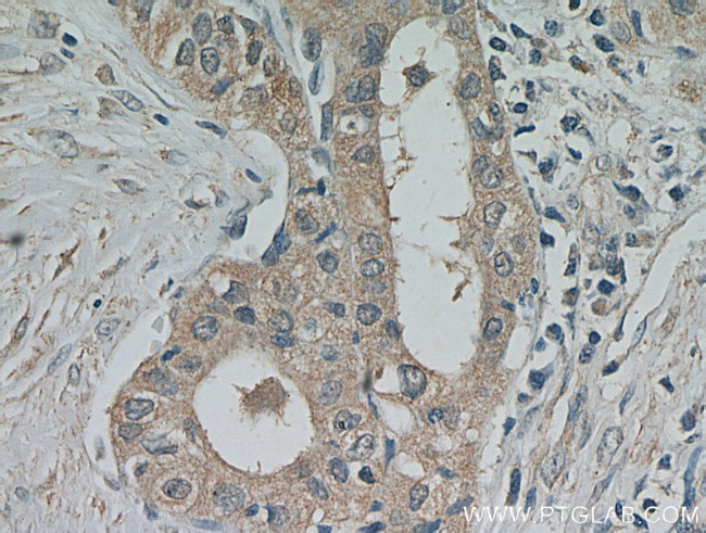 PKC epsilon Antibody in Immunohistochemistry (Paraffin) (IHC (P))