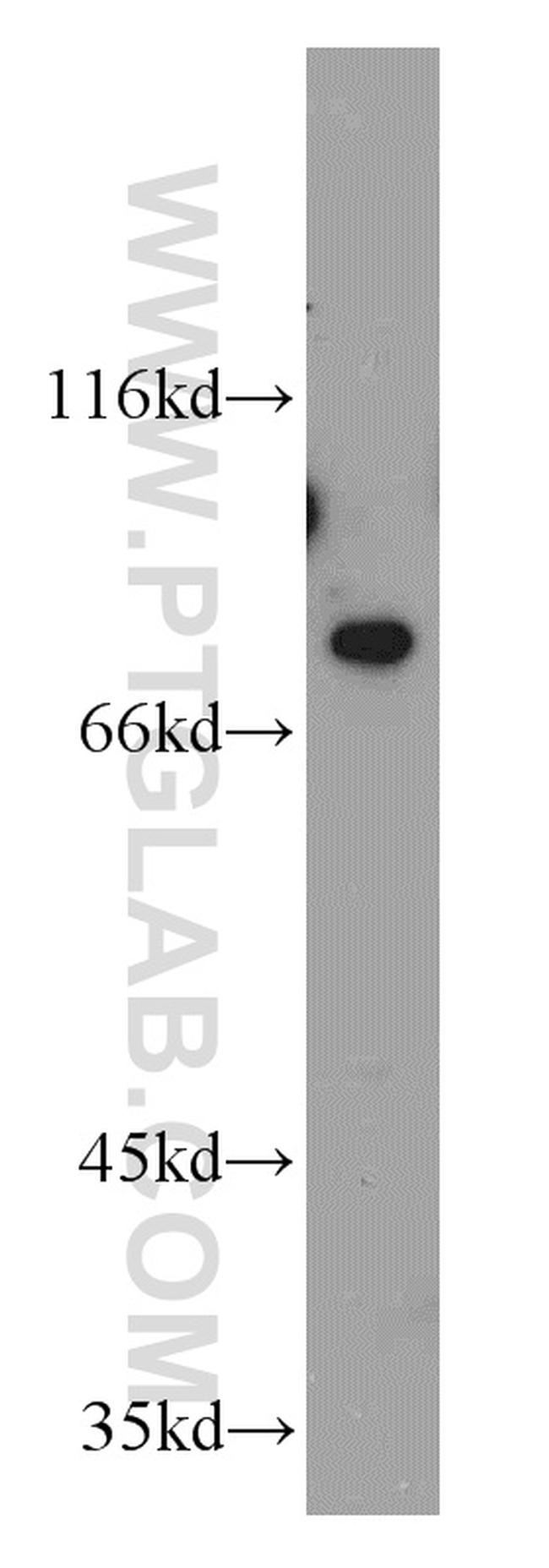 PKC epsilon Antibody in Western Blot (WB)