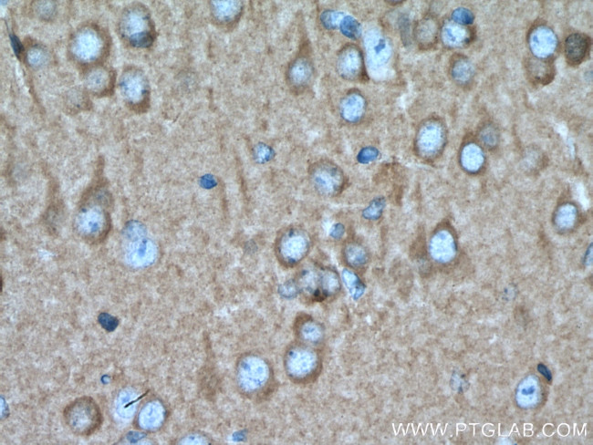 PKC epsilon Antibody in Immunohistochemistry (Paraffin) (IHC (P))