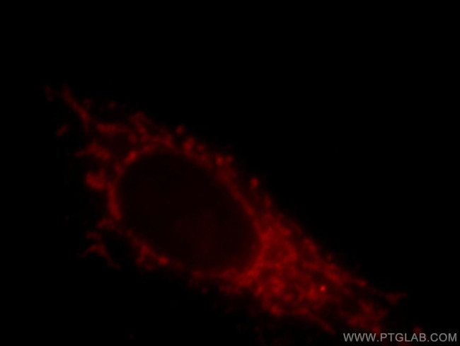 LZTS1 Antibody in Immunocytochemistry (ICC/IF)