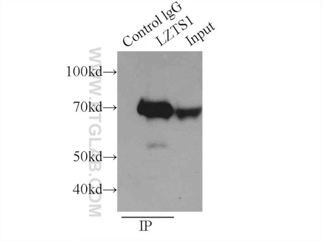 LZTS1 Antibody in Immunoprecipitation (IP)