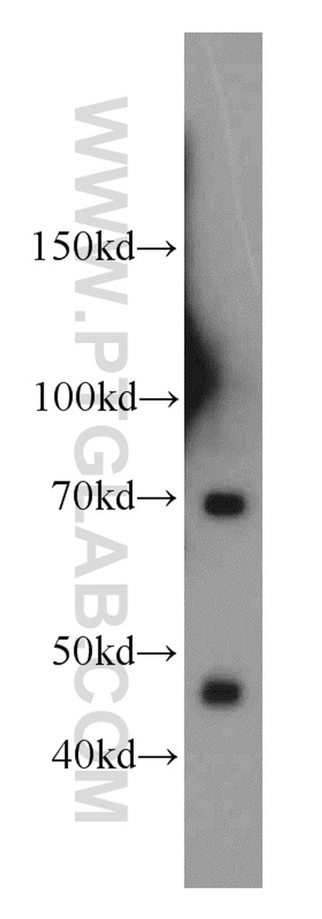 LZTS1 Antibody in Western Blot (WB)