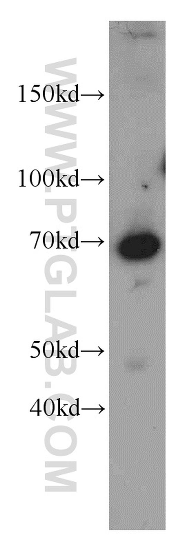 LZTS1 Antibody in Western Blot (WB)