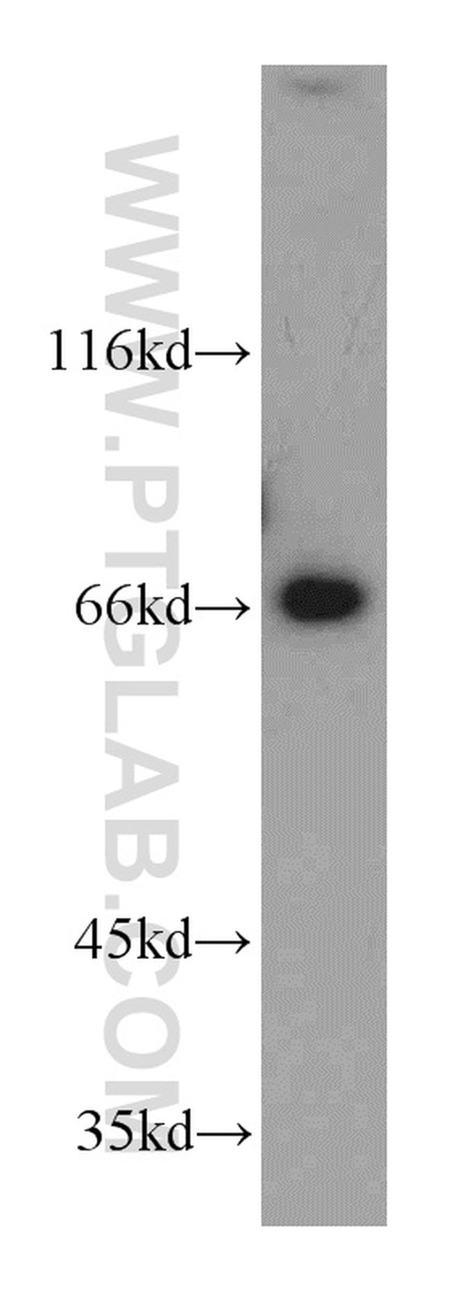 LZTS1 Antibody in Western Blot (WB)