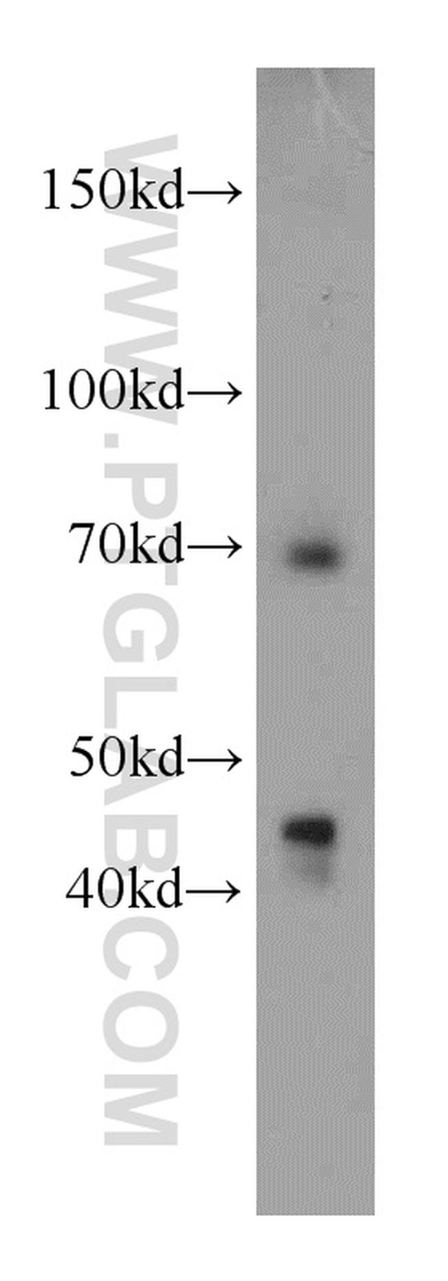 LZTS1 Antibody in Western Blot (WB)