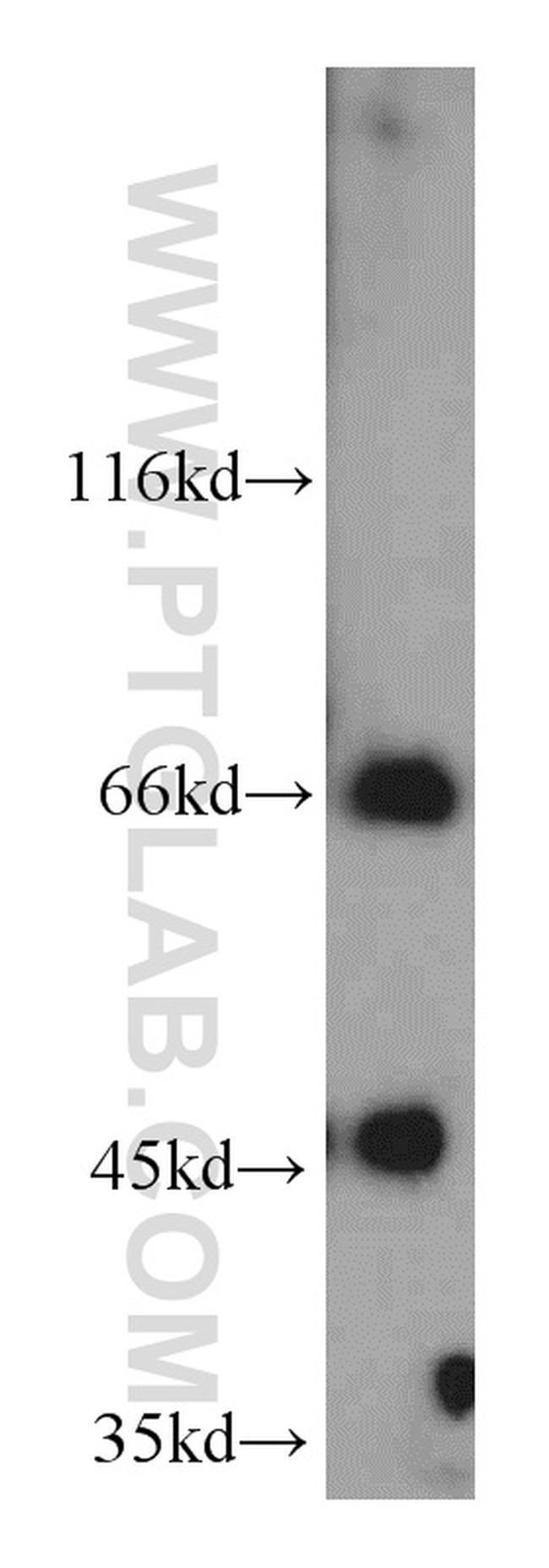 LZTS1 Antibody in Western Blot (WB)